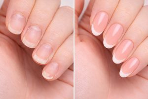 Nail Creation's TIX-O UV gel applied on nails